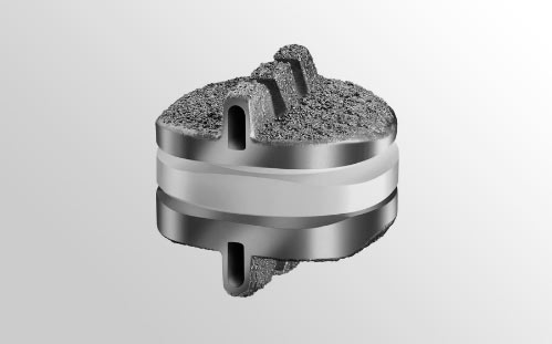 SecureC_motion-preservation-implant